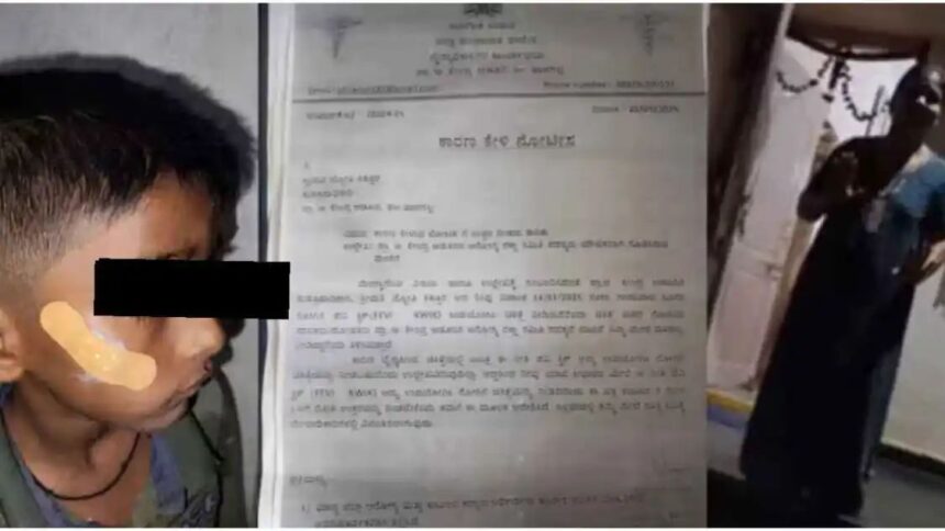 ಗಾಯವಾದ ಬಾಲಕನಿಗೆ ಹೊಲಿಗೆ ಹಾಕುವ ಬದಲು ಪೇವಿಕ್ವಿಕ್ ಹಾಕಿದ ನರ್ಸ್ ಗಾಯವಾದ ಬಾಲಕನಿಗೆ ಹೊಲಿಗೆ ಹಾಕುವ ಬದಲು ಪೇವಿಕ್ವಿಕ್ ಹಾಕಿದ ನರ್ಸ್