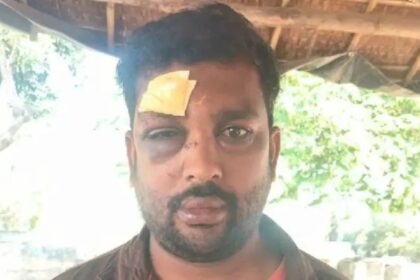 “ಯಾರನ್ನು ಕೇಳಿ ಬಸ್ ದರ ಹೆಚ್ಚಿಸಿದ್ದೀರಿ” : ಕಂಡಕ್ಟರ್ ಮೇಲೆ ಕಲ್ಲಿನಿಂದ ಹಲ್ಲೆ 