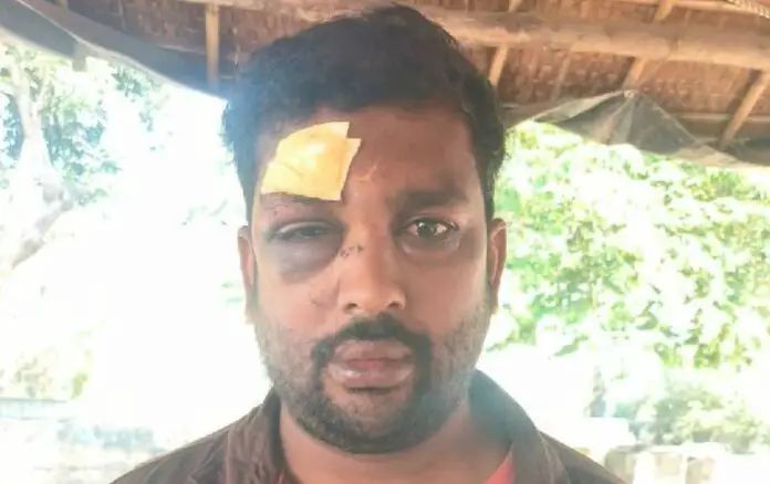 “ಯಾರನ್ನು ಕೇಳಿ ಬಸ್ ದರ ಹೆಚ್ಚಿಸಿದ್ದೀರಿ” : ಕಂಡಕ್ಟರ್ ಮೇಲೆ ಕಲ್ಲಿನಿಂದ ಹಲ್ಲೆ “ಯಾರನ್ನು ಕೇಳಿ ಬಸ್ ದರ ಹೆಚ್ಚಿಸಿದ್ದೀರಿ” : ಕಂಡಕ್ಟರ್ ಮೇಲೆ ಕಲ್ಲಿನಿಂದ ಹಲ್ಲೆ