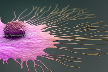 ಸ್ತನ ಕ್ಯಾನ್ಸರ್​ನಿಂದ ಬಳಲುತ್ತಿರುವವರಿಗೆ ತುರ್ತು ಶಸ್ತ್ರ ಚಿಕಿತ್ಸೆ ಅಗತ್ಯ: ಅಧ್ಯಯನ