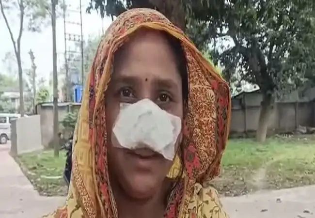 ಪತ್ನಿಯ ಮೂಗು ಸುಂದರವಾಗಿದೆ ಎಂದು ಕಚ್ಚಿ ತಿಂದ ಪತಿರಾಯ ಪತ್ನಿಯ ಮೂಗು ಸುಂದರವಾಗಿದೆ ಎಂದು ಕಚ್ಚಿ ತಿಂದ ಪತಿರಾಯ