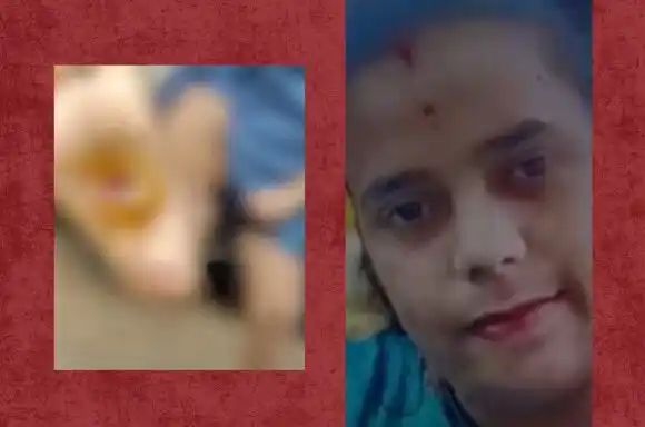 ಮಗು ತುಂಟಾಟ ಮಾಡಿದಕ್ಕೆ ಕಬ್ಬಿಣದ ರಾಡ್ನಿಂದ ಬರೆ ಎಳೆದ ತಾಯಿ ಮಗು ತುಂಟಾಟ ಮಾಡಿದಕ್ಕೆ ಕಬ್ಬಿಣದ ರಾಡ್ನಿಂದ ಬರೆ ಎಳೆದ ತಾಯಿ