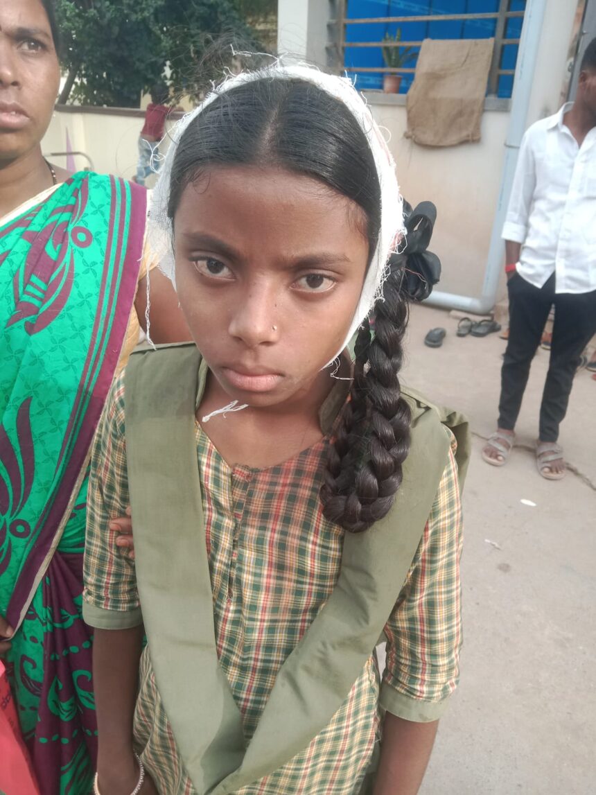 ಮೂವರು ಮಕ್ಕಳು ಗಂಭೀರ ಗಾಯ:ಅನಿಲ್ ಆಕ್ರೋಶ ಮೂವರು ಮಕ್ಕಳು ಗಂಭೀರ ಗಾಯ:ಅನಿಲ್ ಆಕ್ರೋಶ