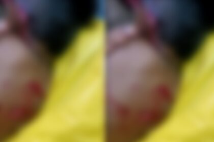 ಸಾಕಿದ ನಾಯಿ ಬಾಲಕನ ಮೇಲೆ ದಾಳಿ