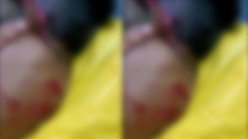 ಸಾಕಿದ ನಾಯಿ ಬಾಲಕನ ಮೇಲೆ ದಾಳಿ ಸಾಕಿದ ನಾಯಿ ಬಾಲಕನ ಮೇಲೆ ದಾಳಿ