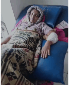 ನಿರಂತರ ಮಳೆ: ಬೇಡಕಿಹಾಳದಲ್ಲಿ ಗೋಡೆ ಕುಸಿದು ಮಹಿಳೆಗೆ ಗಾಯ