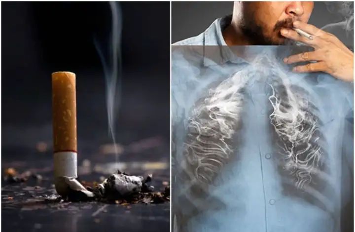 ತಂಬಾಕು ಸೇವನೆಯಿಂದ ಪ್ರತಿ ವರ್ಷ ಭಾರತದಲ್ಲಿ 13.5 ಲಕ್ಷ ಜನ ಸಾವು