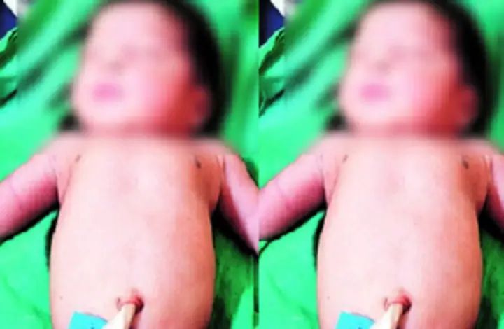 ಸರ್ಕಾರಿ ಆಸ್ಪತ್ರೆಯ ಶೌಚಗೃಹದ ಬಕೆಟ್ ನಲ್ಲಿ ಹೆಣ್ಣು ಶಿಶು ಪತ್ತೆ 