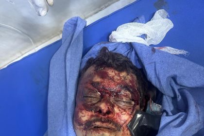 ಕಾರು ಅಪಘಾತದಲ್ಲಿ ಐಎಎಸ್ ಅಧಿಕಾರಿ ಮಹಾಂತೇಶ್ ಬೀಳಗಿ ಸಾವು 