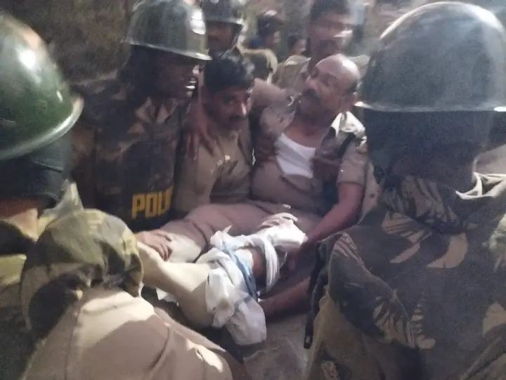 ಬೆಂಕಿ ಅವಘಡದ ಗುಂಪುಗಳ ನಡುವೆ ಕಲ್ಲು ತೂರಾಟ : ಎಎಸ್ಪಿ ಕಾಲು ಮುರಿತ, ಬೆಂಗಳೂರಿಗೆ ಶಿಫ್ಟ್ 