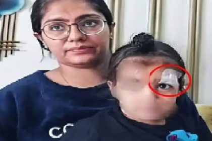 ಕಣ್ಣಿಗೆ ಚಿಕಿತ್ಸೆ ನೀಡುವ ಬದಲು ಫೆವಿಕ್ವಿಕ್ ಹಾಕಿದ ವೈದ್ಯರು 