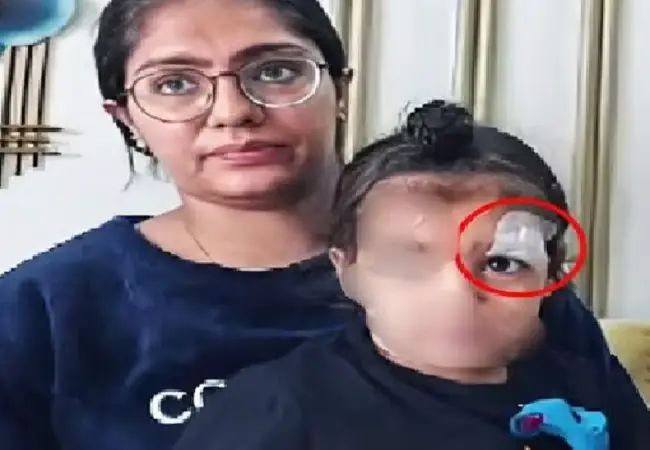 ಕಣ್ಣಿಗೆ ಚಿಕಿತ್ಸೆ ನೀಡುವ ಬದಲು ಫೆವಿಕ್ವಿಕ್ ಹಾಕಿದ ವೈದ್ಯರು 