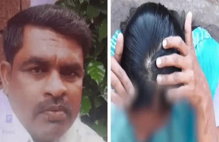 ಮೂರು ಹೆಣ್ಣು ಮಕ್ಕಳನ್ನು ಹೆತ್ತ ಪತ್ನಿ : 4ನೇ ಮಗು ಗಂಡಾಗಲಿ ಎಂದು ತಲೆ ಕೂದಲು ಕತ್ತರಿಸಿ ಸುಟ್ಟ ಪತಿ