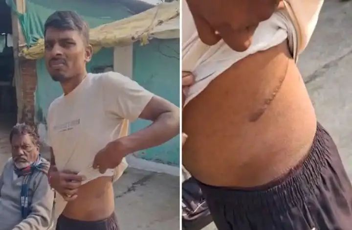 1 ಲಕ್ಷ ರೂ. ಸಾಲಕ್ಕೆ 75 ಲಕ್ಷ ರೂ. ಬಡ್ಡಿ : ಕಿಡ್ನಿ ಮಾರಿದ ರೈತ 1 ಲಕ್ಷ ರೂ. ಸಾಲಕ್ಕೆ 75 ಲಕ್ಷ ರೂ. ಬಡ್ಡಿ : ಕಿಡ್ನಿ ಮಾರಿದ ರೈತ