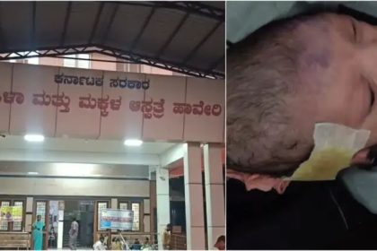 ಜಿಲ್ಲಾಸ್ಪತ್ರೆ ಯಡವಟ್ಟು : ಸಿಸೇರಿಯನ್ ವೇಳೆ ಶಿಶುವಿನ ತಲೆಗೆ ಕತ್ತರಿ ಹಾಕಿದ ವೈದ್ಯರು