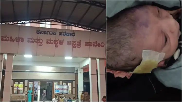 ಜಿಲ್ಲಾಸ್ಪತ್ರೆ ಯಡವಟ್ಟು : ಸಿಸೇರಿಯನ್ ವೇಳೆ ಶಿಶುವಿನ ತಲೆಗೆ ಕತ್ತರಿ ಹಾಕಿದ ವೈದ್ಯರು