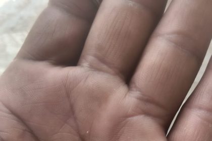 ಮೇದಕ್ ಶಾಲೆಯ ಮದ್ಯಾಹ್ನದ ಊಟದ ಅಕ್ಕಿಯಲ್ಲಿ ಹುಳ ಮತ್ತು ಕಲ್ಲುಗಳು:ನರೇಶ್ ಆಕ್ರೋಶ.