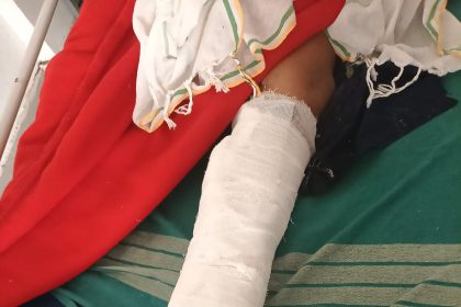 ಶಿಕ್ಷಕರ ಕಿರುಕುಳ ಸಹಿಸದೇ ಯುವತಿ ಆತ್ಮಹತ್ಯೆಗೆ ಯತ್ನ