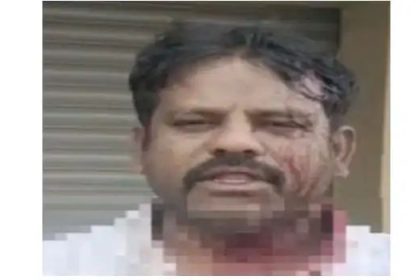 ಲೇಬರ್ ಯುನಿಯನ್ ಅಧ್ಯಕ್ಷನ ಮೇಲೆ ಸವದಿ ಕುಟುಂಬದಿಂದ ಮಾರಣಾಂತಿಕ ಹಲ್ಲೆ ಆರೋಪ 