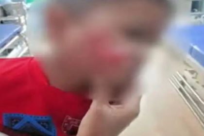 ಬೆಳಗಾವಿಯಲ್ಲಿ 2 ವರ್ಷದ ಮಗುವಿನ ಮೇಲೆ ಬೀದಿ ನಾಯಿಗಳ ಡೆಡ್ಲಿ ಅಟ್ಯಾಕ್