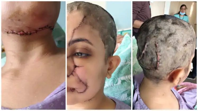 ಸಾಕು ನಾಯಿ ಡೆಡ್ಲಿ ಅಟ್ಯಾಕ್ : ಮಹಿಳೆಗೆ ಬಿತ್ತು 50ಕ್ಕೂ ಹೆಚ್ಚು ಹೂಲಿಗೆ, ಎಫ್‌ಐಆರ್ ದಾಖಲು