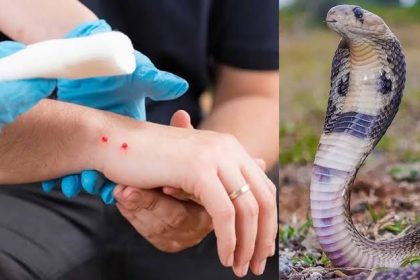 ರಾಜ್ಯದಲ್ಲಿ ಕಳೆದ 3 ವರ್ಷಗಳಲ್ಲಿ 36,636 ಹಾವು ಕಡಿತ ಕೇಸ್ : 273 ಜನ ಸಾವು