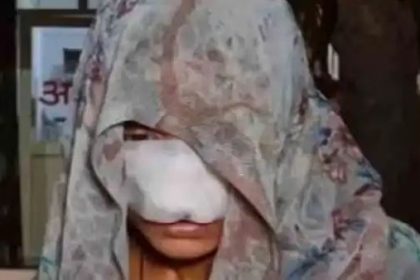 ಪತ್ನಿಯ ಮೂಗು ಮತ್ತು ಕೆನ್ನೆ ಕಚ್ಚಿ ತೀವ್ರವಾಗಿ ಹರೆದ ಪತಿ : 12 ಹೊಲಿಗೆ