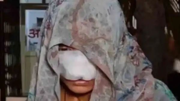 ಪತ್ನಿಯ ಮೂಗು ಮತ್ತು ಕೆನ್ನೆ ಕಚ್ಚಿ ತೀವ್ರವಾಗಿ ಹರೆದ ಪತಿ : 12 ಹೊಲಿಗೆ